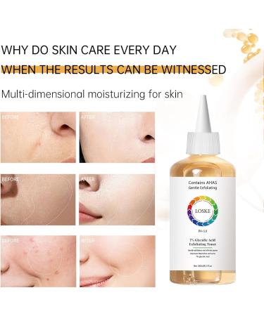 7% Glycolic Acid Face Exfoliating Toner for Clear Skin Pore Minimizer Radiant Complexion Enhancer Daily Use Gentle Formula Suitable for All Skin Types 8.44 Fl Oz (Pack of 1) - Buy Online on GoSupps.com