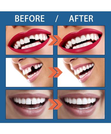 XiaoXIN Moldable False Teeth - 25g Bottle for Denture Cosplay & Halloween Party Props - Buy Online on GoSupps.com