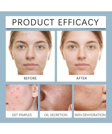 Hydrating Cleansing Gel - Brighten & Moisturize Skin Soothe Sensitivity Daily Facial Cleanser For All Skin Types(3PCS) - Buy Online on GoSupps.com