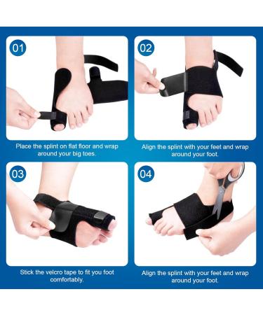 Bunion Correction Kit - 2pc Big Toe Spacers & Adjustable Splint for Hallux Valgus Relief | Orthopedic Toe Separators for Men & Women - Buy Online on GoSupps.com
