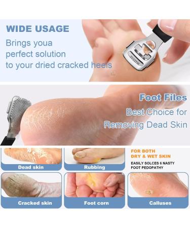 Professional Stainless Steel Foot Files & Callus Remover - 10 Replacement Blades & 1 Foot File Head for Smooth Feet - Ideal Pedicure Tool for Hard Skin & Corns - Black - Buy Online on GoSupps.com