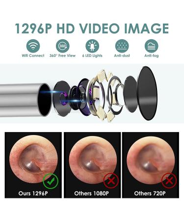 Smart Visual Ear Cleaner | Wireless Ear Wax Removal Tool Camera | 1296P FHD Otoscope with 6 LED Lights | IP67 Waterproof | Ear Camera for iPhone, iPad, Android | Black - Buy Online on GoSupps.com