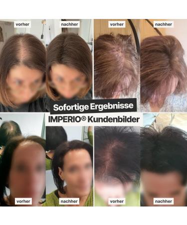 Imperio Scatter Hair - 100% Natural Hair Compression & Instant Volume | Premium Quality Dark Brown (26g) | Authentic Purple Look - Fast International Shipping - Buy Online on GoSupps.com