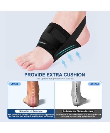 Arch Support Inserts & Compression Bands for Plantar Fasciitis Relief | Orthotic Sleeves with Gel Pads for Flat Fallen & High Arches - One Size Fits All - Buy Online on GoSupps.com