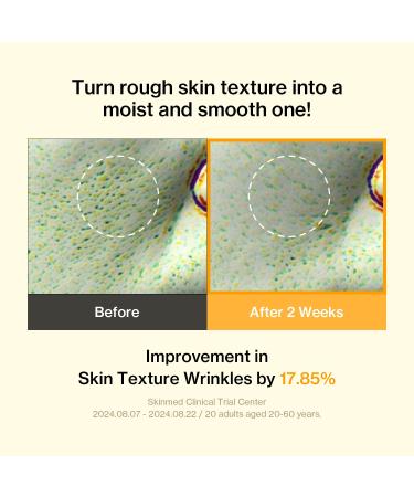 Banatinol Pore Care Cream | Banana & Retinol Formula for Skin Balance & Elasticity | Lightweight, Fast-Absorbing, Vegan & Clean Beauty | 1.69 Fl oz - Buy Online on GoSupps.com