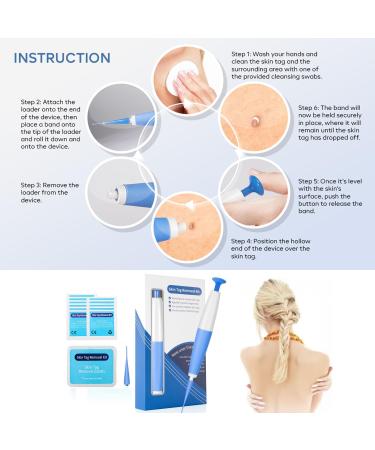 Skin Cleaing Tool Kit for Men and Women Skin Cleaning Kit for Small (2mm) to Medium (4mm) Skin Tags Safe for Most Parts(Blue) - Buy Online on GoSupps.com