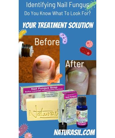 Naturasil Nail Fungus Treatment Bundle - Fast-Acting Solution for Healthy Nails - Buy Online on GoSupps.com