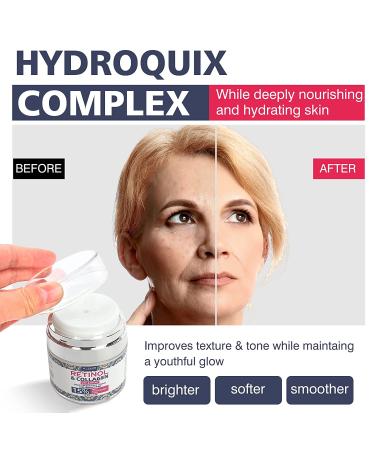 Retinol Cream with Hyaluronic Acid & Collagen | Anti-Aging Moisturizer for Face & Neck | Day & Night Wrinkle Cream for Women & Men | All Skin Types - Buy Online on GoSupps.com