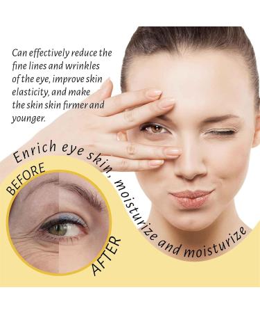 Rollerball Castor Oil & Frankincense Eye Roller | Reduce Dark Circles & Bags Under Eyes - International Shipping - Buy Online on GoSupps.com