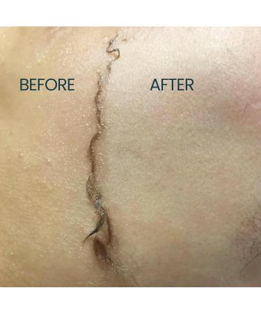 Dermaplane Oil for Women with Sensitive Skin - Face Shaving Oil - Non Comedogenic Fragrance Free Natural & Lightweight - Use with Dermaplane Razor for Women Face 2oz by Ouiloe For Sensitive Skin 2 Fl Oz (Pack of 1) - Buy Online on GoSupps.com