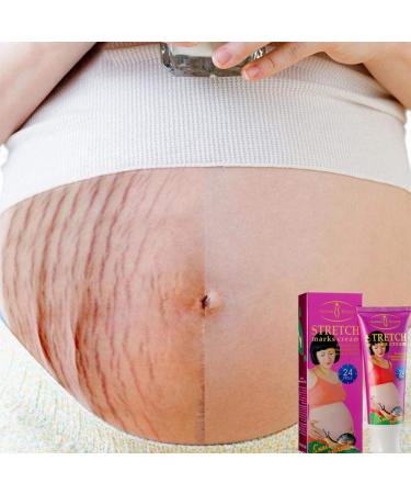 AICHUN BEAUTY Stretch Marks Cream with Snail Extract | Reduce Scars & Repair Damaged Skin | 120g - International Shipping Available - Buy Online on GoSupps.com