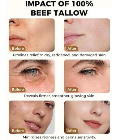  ZLHHRZJX Face Cream with Ox Tallow and Frankincense Anti-Dryness Balm Moisturizing Balm with Ox Tallow and Honey Daily Moisturizing Face Cream Multi-Purpose Face Cream (2 PCS) - Buy Online on GoSupps.com