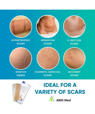 AWD Silicone Scar Sheets for Effective Scar Removal | Surgical C Section Keloid Tummy Tuck Tape - 5 Pcs 1.6 x 6 Nude - Must-Have Skin Patches - Buy Online on GoSupps.com