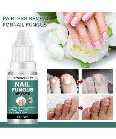 Fungal Nail Treatment + Nail File | Extra Strong Ingrown Toenail Care Oils | Anti Toe Nail Fungus Solution (10ML) - Buy Online on GoSupps.com