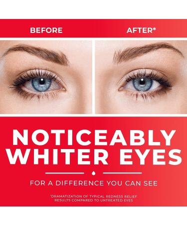 Buy Clear Eyes Redness Relief Eye Drops 0.2oz | Fast Shipping Worldwide - Buy Online on GoSupps.com