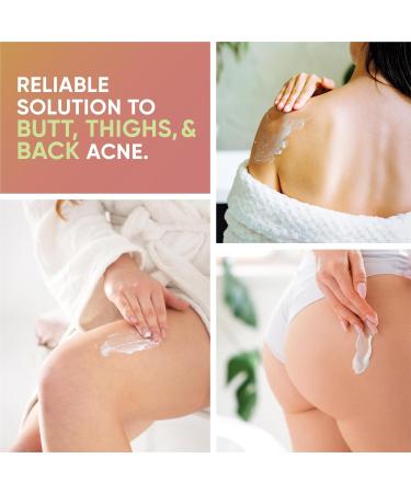 HAIRO RELIEF - Butt Acne Treatment 100ml | Targets Pimples & Acne on Butt Thighs & Back | Body Acne Treatment - Buy Online on GoSupps.com