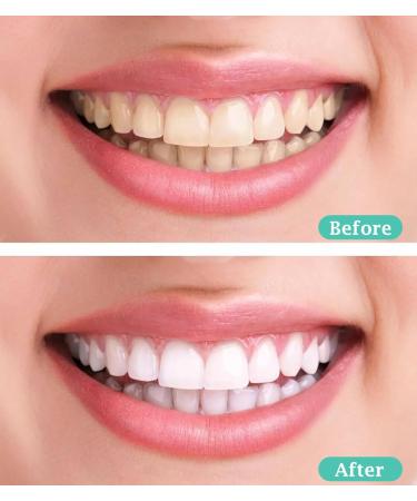 Buy Bituocs 200 Interdental Brushes - Effective Bendable Toothpicks for Plaque Removal | Fast International Shipping - Buy Online on GoSupps.com