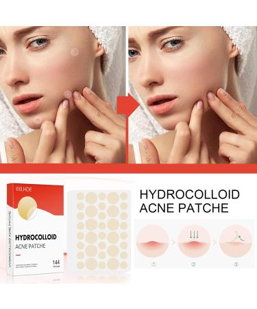 Hydrocolloid Acne Patches - 144 Invisible Spot Patches for Face & Body, 8mm & 12mm - Calms & Relieves Acne Quickly - Buy Online on GoSupps.com