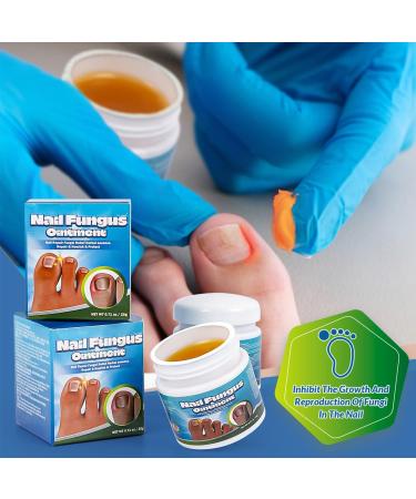 Soins des ongles de pied endog nes Cr me r paratrice pour les ongles Ongles R parateurs Renforce Les Ongles Favorise La Repousse D'ongles Sains Cr me professionnelle pour le soin des pieds(20g) - Buy Online on GoSupps.com