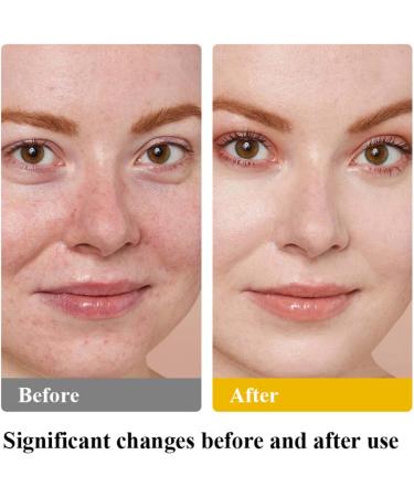 Tallow Honey Balm Tallow Moisturiser Firming Face Cream Face Moisturiser for Whole Body Face Hand Leg Face Cream for Women Skin Tightening Cream for Face Day Cream Anti Wrinkle Face Cream for Dry Skin - Buy Online on GoSupps.com