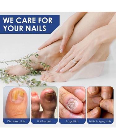 3 Pcs German Paronychia Oil for Toenail Care | Repair & Improve Toenail Health - Buy Online on GoSupps.com
