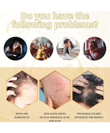 Castor Oil For Hair Growth- 30ml Cold Pressed Castor Oil For Eyelashes And Eyebrows With Eyelash Brush Skin Care Ricin Oil For Dry Damaged Hair And Growth - Buy Online on GoSupps.com