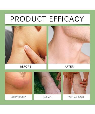 Cr me d toxifiante lymphatique base de plantes cr me d tumescente naturelle pour les jambes contient des ingr dients naturels base de plantes peut soulager les jambes le cou les aisselles et 5pcs - Buy Online on GoSupps.com