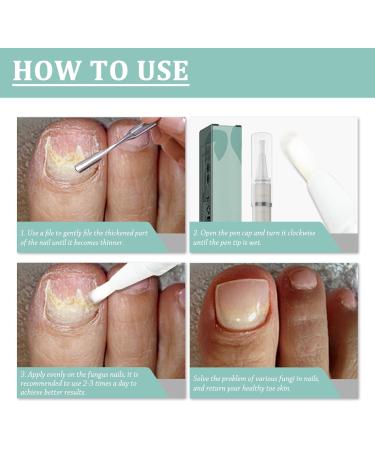 Nail care pen with tea tree oil aloe vera and vitamin E repair and care for fingernails and toenails promotes healthy nail growth nail care pen against brittle and discolored nails - Buy Online on GoSupps.com