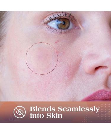 AUSLKA Pimple Patches (174 Patches) - Hydrocolloid Patches - Invisible Pimple Spot Stickers - Facial Stickers All Skin Types - Buy Online on GoSupps.com
