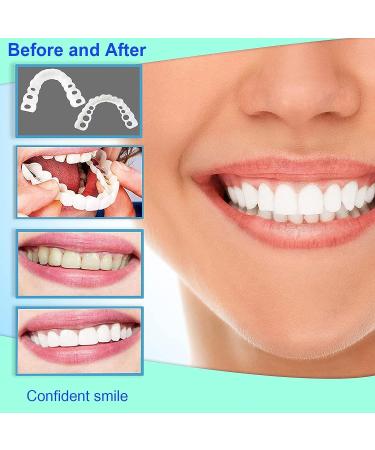 Dentures Fake Smile Teeth - Moldable & Customizable Top Teeth for Instant Snap On - Temporary Solution for Confidence Smile (3 Boxes) - Buy Online on GoSupps.com
