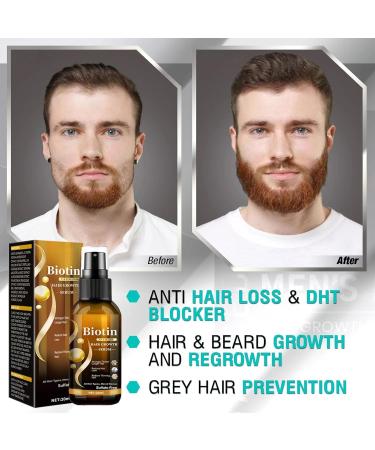 Hair Growth Spray - Hair Growth Serum with Biotin - Hair Serum for Hair Growth - Hair Loss Treatment For Men Women - Biotin Thickening Herbal Serum - Biotin Premium Herbal Serum - 20ml - Buy Online on GoSupps.com