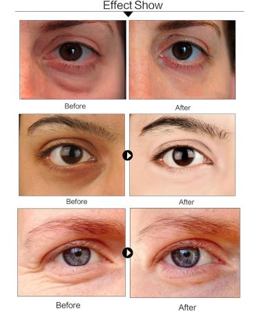 Vitamin C Collagen Under Eye Patches - 30 Pairs | Dark Circles & Puffy Eyes Treatment Mask - Buy Online on GoSupps.com