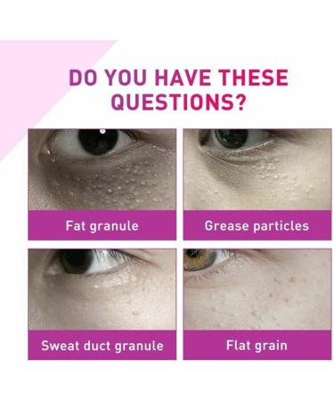 ZHBiwmatn 2024 New 4Pcs Milia Clearing Essence Milia Remover Eye Serum Milia Remover Milia Spot Treatment Miliary Repair Essence Moisturize Skin Improve Skin Texture for All Skin Types 30ml/1.8fl.oz - Buy Online on GoSupps.com