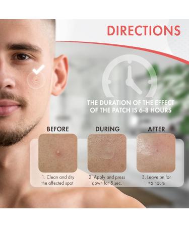 AX Acne Hydrocolloid Pimple Patch Bandage Variety Pack | Skincare Spot Treatment for Clearing Pores and Blemishes - Buy Online on GoSupps.com