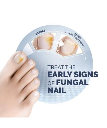 Scholl Fungal Nail Treatment 3.8ml - Effective Nail Fungus Remedy - Buy Online on GoSupps.com