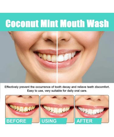 Oralhoe Coconut Mint Mouthwash & Oil Pulling - Natural Teeth Whitening with Peppermint - 1PC - Buy Online on GoSupps.com