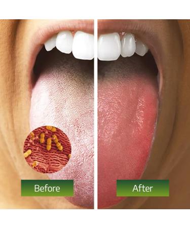 Metal Tongue Scraper - Stainless Steel Tongue Cleaner Tool for Fresh Breath- U-Shaped Travel Tongue Scraper with Flexible Design (1 Pack U-Shape Scraper) - Buy Online on GoSupps.com