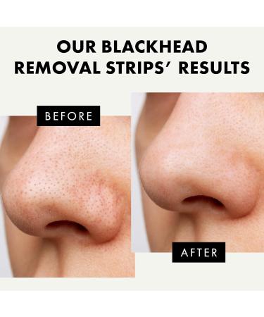 Activated Charcoal Nose Pore Strips - Blackhead Remover & Pore Cleanser - 4 Pcs - Buy Online on GoSupps.com