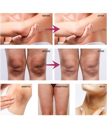 Underarm Whitening Cream Vitamin C Whitening Cream for Body Skin Whitening Cream Armpit Whitening Cream Body Whitening Cream for Dark Skin Body Moisturiser for Intimate Areas Bikini Line&Armpit - Buy Online on GoSupps.com