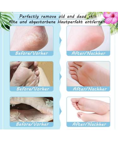 Skymore Foot Mask - Exfoliating Peeling Socks for Soft Feet | 2 Pairs - Cornea Removal Treatment - Buy Online on GoSupps.com