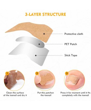 Xinzan 2 Types Ingrown Toenail Treatment Patch with Ingrown Toenail Tool Professional Ingrown Toenail Corrector Tools for Toenail Care Protect Toe Nail - Buy Online on GoSupps.com