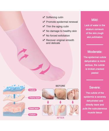 Foot Peel Mask Skin So Soft Foot Mask DYKOOK 1 Pair of Silicone Moisturising Socks Feet Hard Skin Remover Foot Care Footmask Socks Foot Spa Socks for Dry Feet Hard Skin Cracked Heel Dry Skin(S) - Buy Online on GoSupps.com