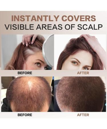 Light Brown Hair Thickener Powder | 4G Attachment Concealer | Waterproof & Windproof for Men & Women - Buy Online on GoSupps.com