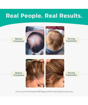 Shapiro MD DHT Fighting Vegan Hair Loss Shampoo & Conditioner | Dermatologist Developed for Thinning Hair | Promotes Healthy, Fuller Looking Hair | 2-Month Supply - Buy Online on GoSupps.com