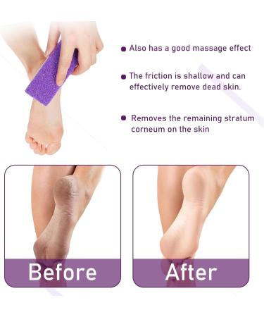 2PCS Double Sided Pumice Stone for Feet - Foot Pedicure Tool for Hard Callus Removal - Buy Online on GoSupps.com