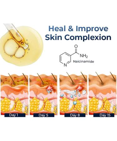 Eczema Therapy Spray Natural Eczema Relief Spray Eczema Treatment Fast Acting Itch Relief (1Pcs) - Buy Online on GoSupps.com