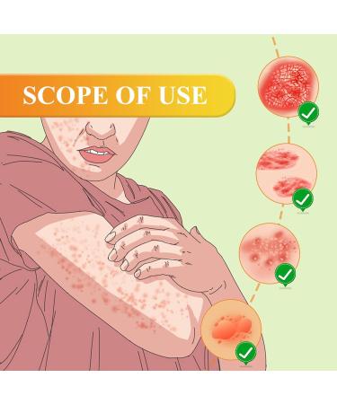 KRRHUEO Bee Venom Psoriasis Treatment Cream - Soothing and Moisturizing Skin Relief (1PCS) - Buy Online on GoSupps.com