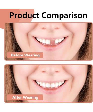 Flipped Warm Tooth Aperture - Comfortable Upper & Lower False Teeth for Perfect Smile | Flexible Braces - Buy Now! - Buy Online on GoSupps.com