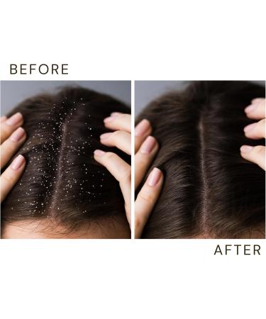 Vitali-Chi VGenere Hair Oil+ - Buy Online on GoSupps.com