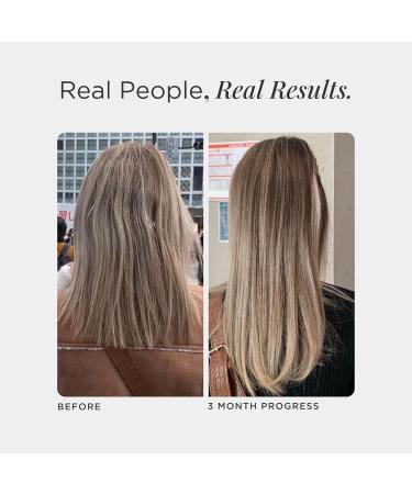 JSHealth Hair Formula - Vitamins for Hair Growth and Energy with Zinc and Iodine - Hair Loss Supplement for Men and Women (60 Capsules) 60 Count (Pack of 1) - Buy Online on GoSupps.com